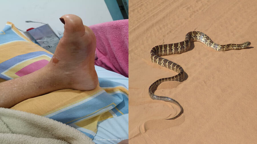 Imagem de compartilhamento para o artigo Mulher é picada por jararacuçu e mobiliza força-tarefa para atendimento em Paraíso das Águas da MS Todo dia